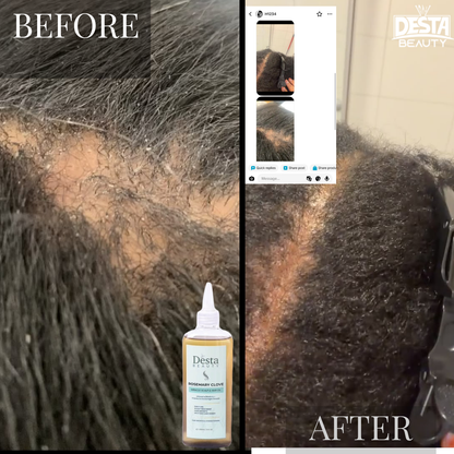 Rosemary Clove Hair Oil