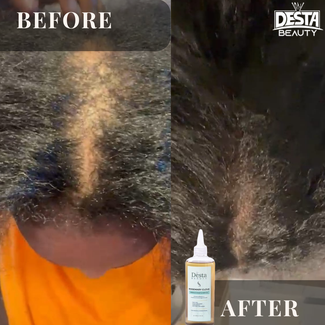 Rosemary Clove Hair Oil