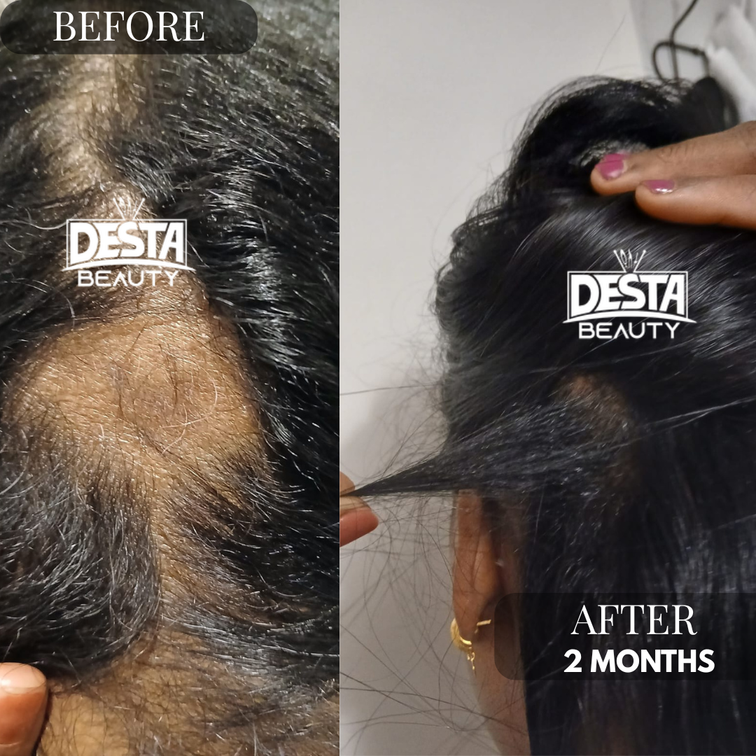 Rosemary Clove Hair Oil