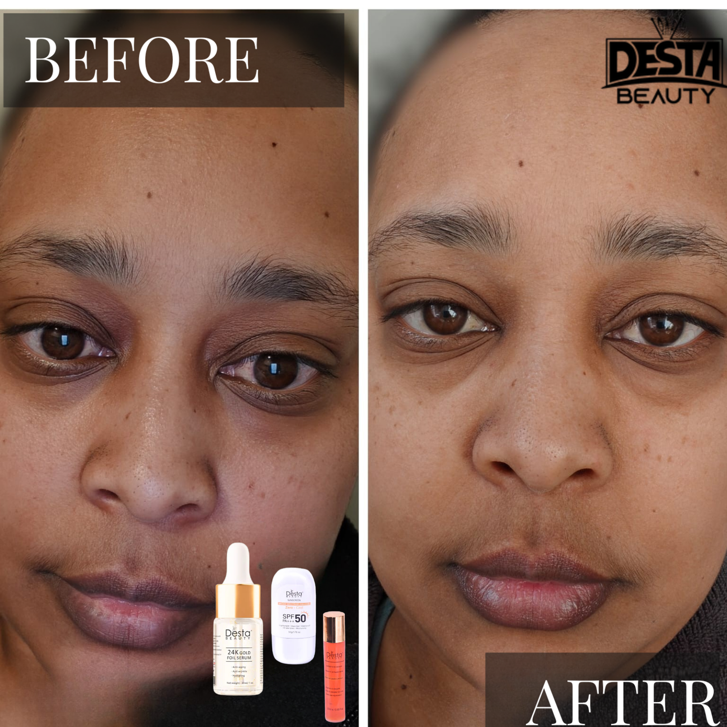 ANTI -AGING BUNDLE