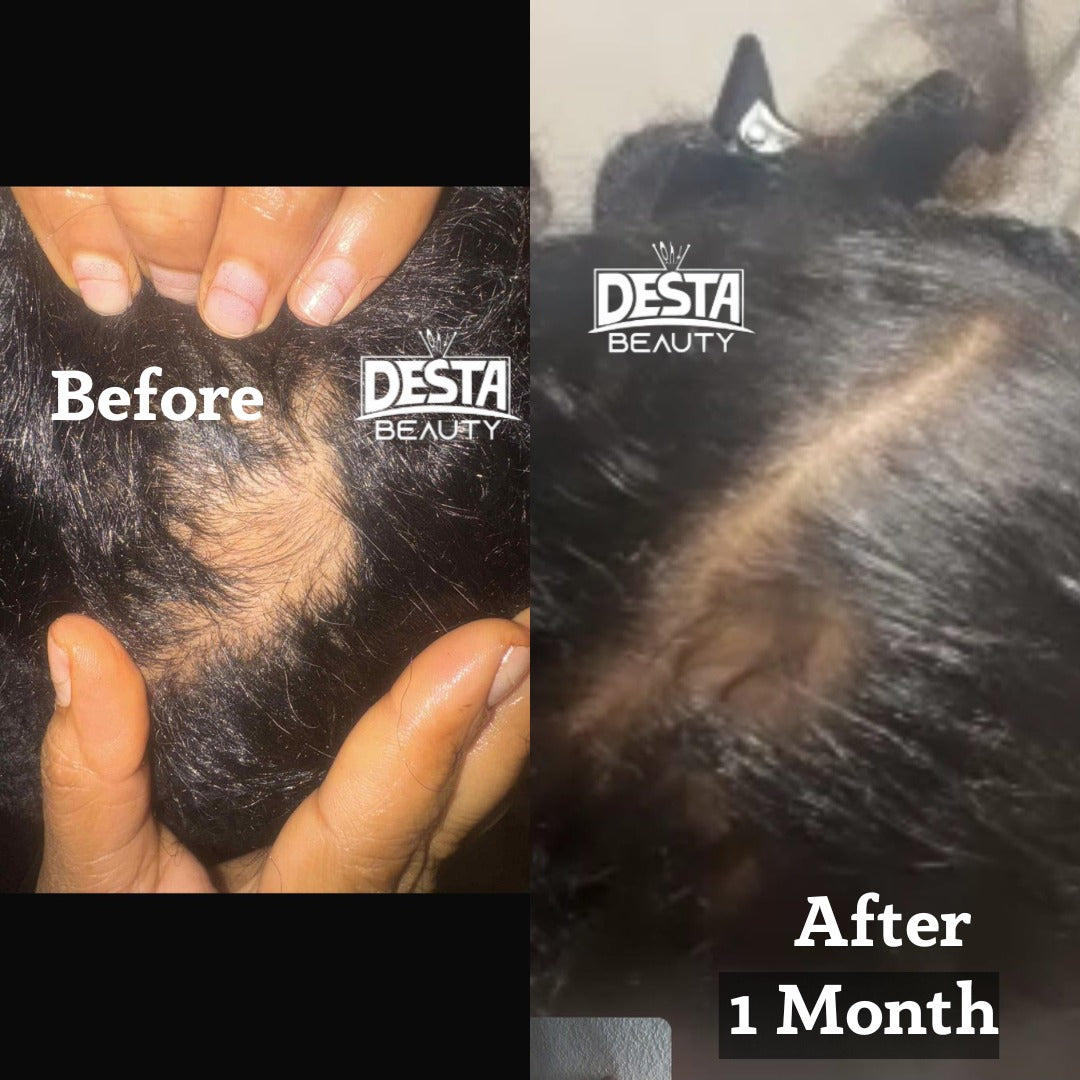 Rosemary Clove Hair Oil