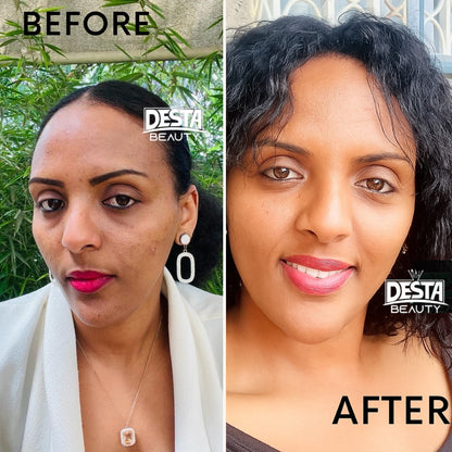 Huile de feuille d'arbre à thé entièrement naturelle Huile essentielle anti-acné - Fruit d'olive hydratant