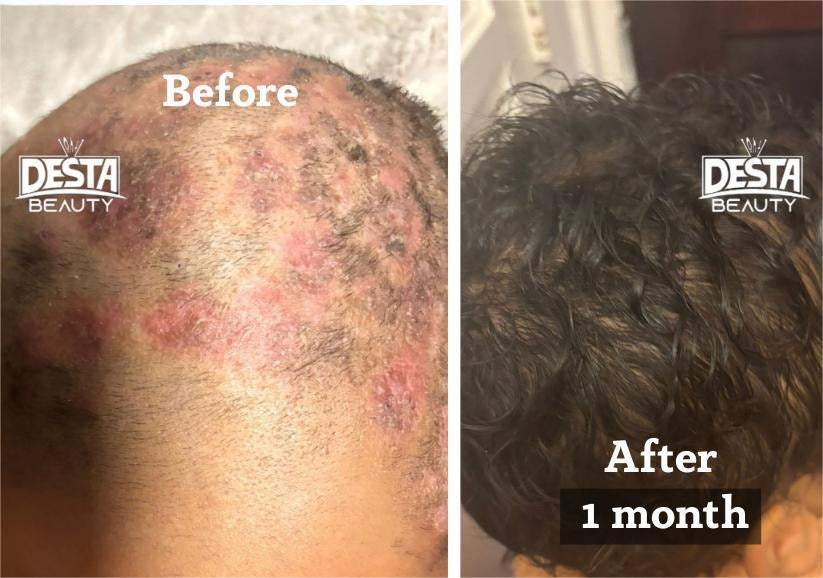 Rosemary Clove Hair Oil