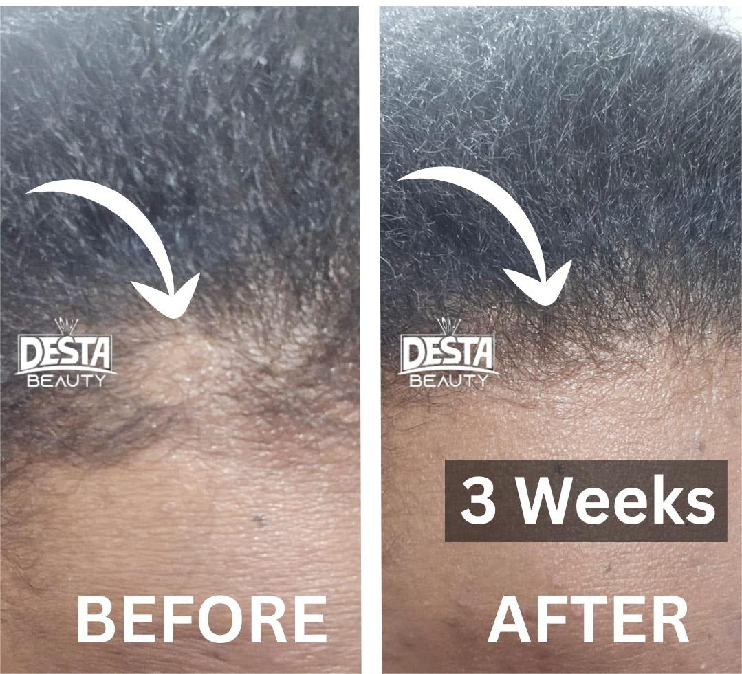 Rosemary Clove Hair Oil