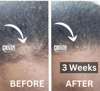 Rosemary Clove Hair Oil