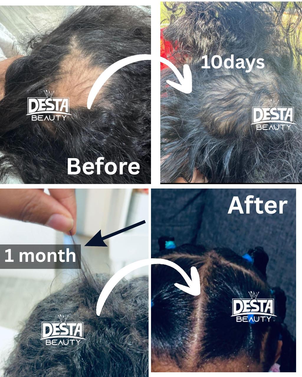 Rosemary Clove Hair Oil