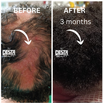 Rosemary Clove Hair Oil