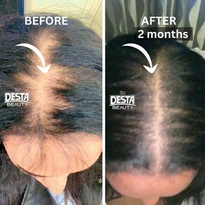 Rosemary Clove Hair Oil