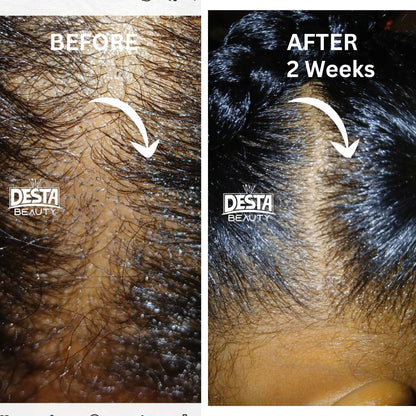 Rosemary Clove Hair Oil