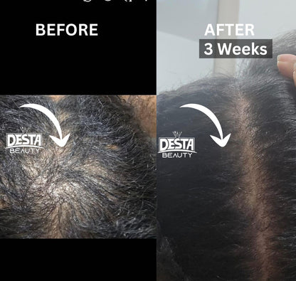 Rosemary Clove Hair Oil