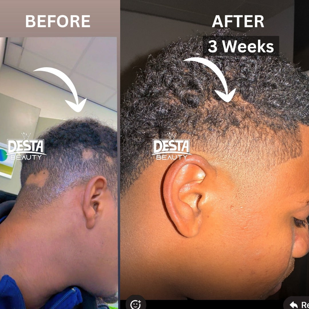 Rosemary Clove Hair Oil