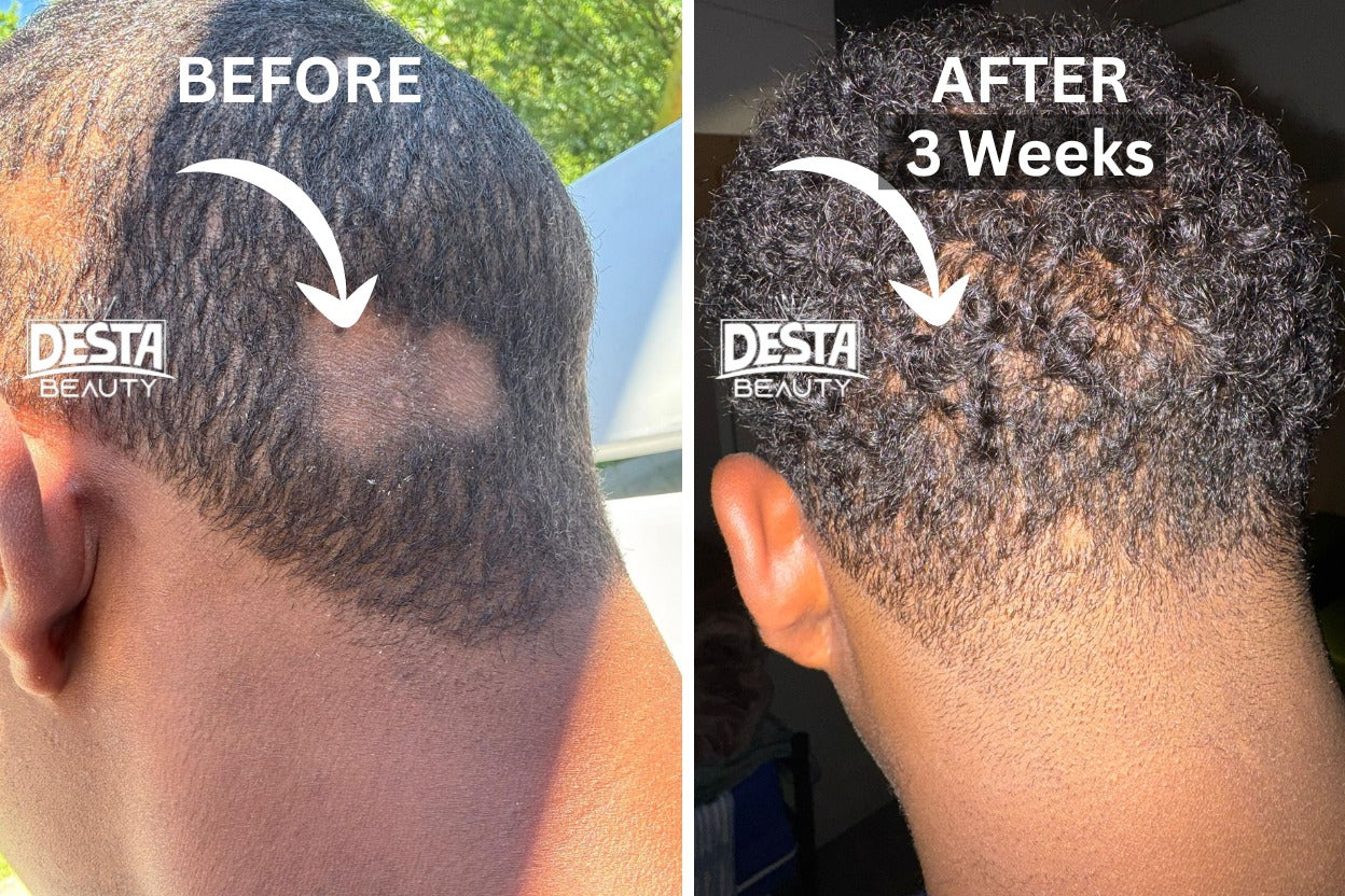 Rosemary Clove Hair Oil