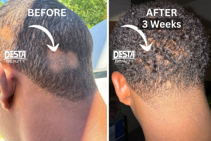 Rosemary Clove Hair Oil